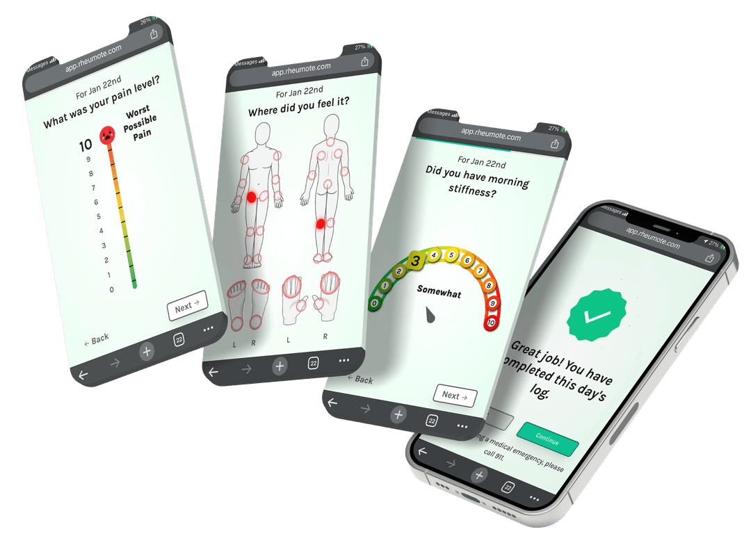 Rheumote Control preview